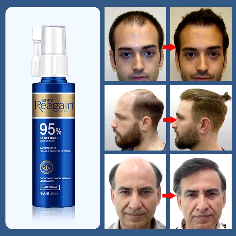 Anti Hair Loss Regrowth Essence Hair Growth Serum Sprayer Hair Regrowth for Men Rapid Growth Essence Prevent Hair from Falling