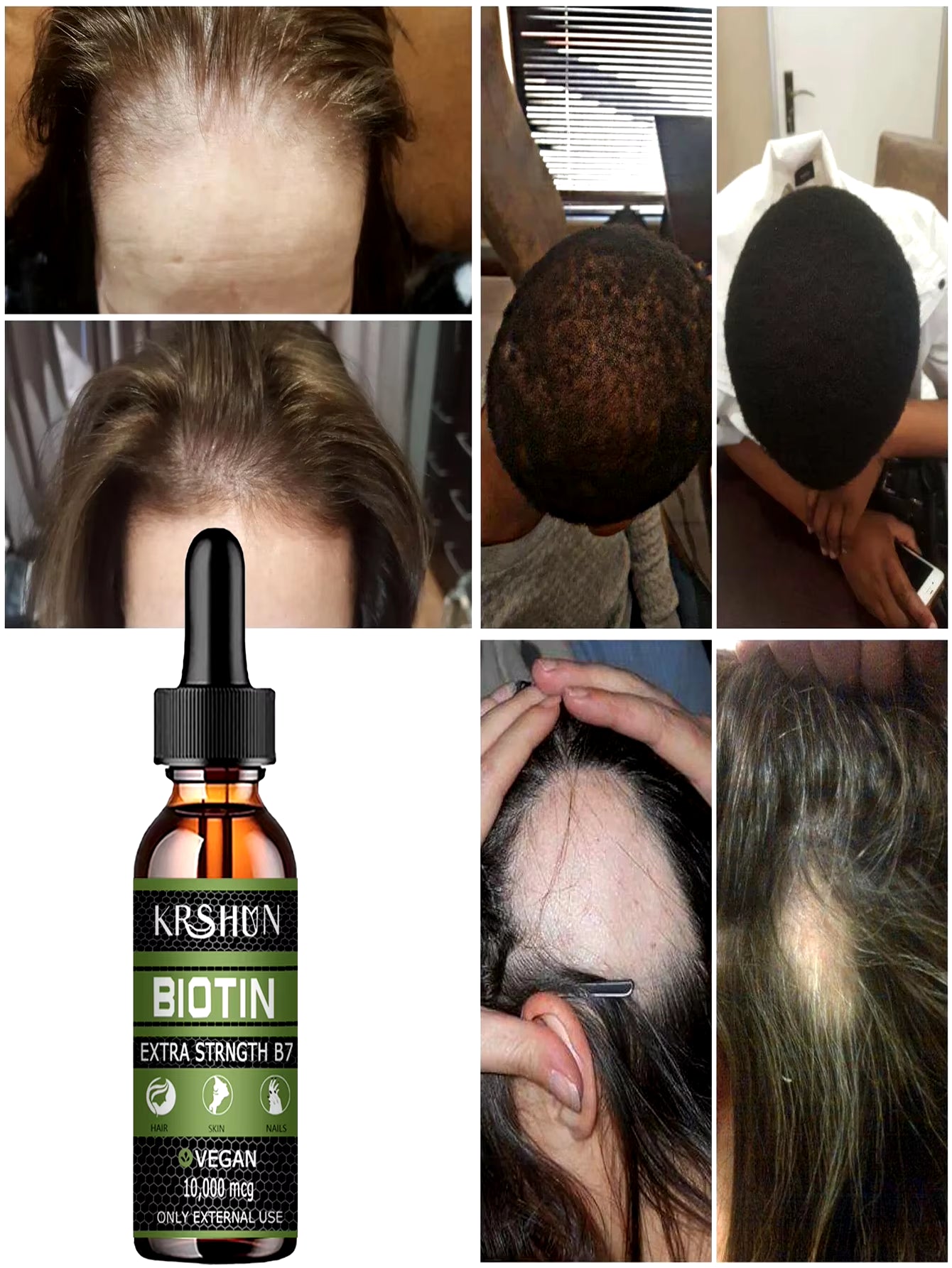 2022 Biotin Fast Hair Growth Oil Hair Regrowth Serum Hair Thinning Treatment Hair Growth Liquid Anti-Hair Loss for Women & Men