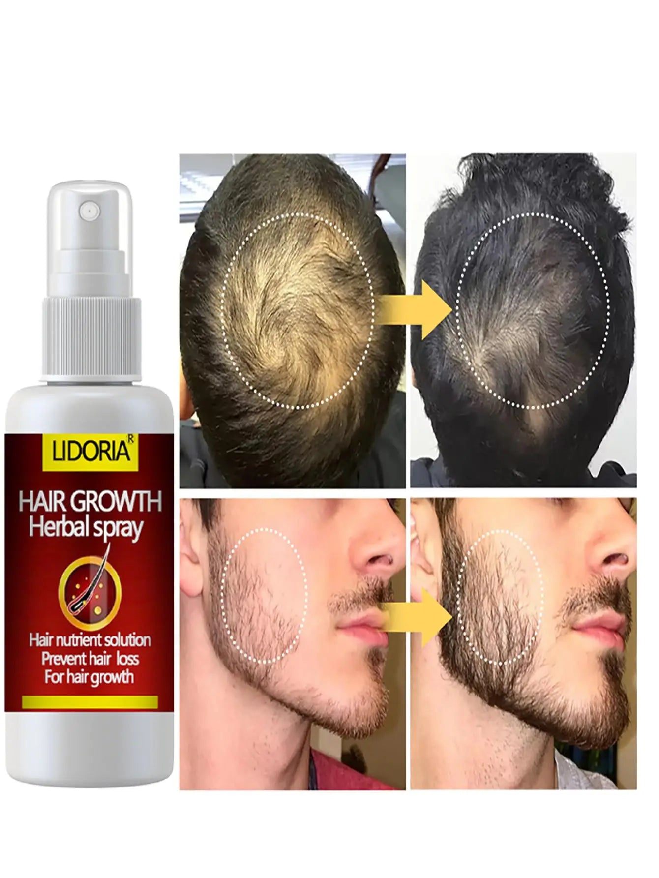 Hair Growth Serum Spray Fast Hair Growth Liquid Treatment Scalp Hair Follicle anti Hair Loss Natural Beauty Health Hair Care