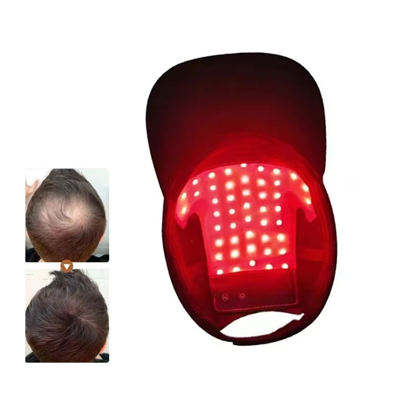 Hat Hair Regrowth Light Therapy Device Hair Growth Cap anti Hair Loss Hair Growth Laser Helmet Hair Growth Treatment Hat Machine