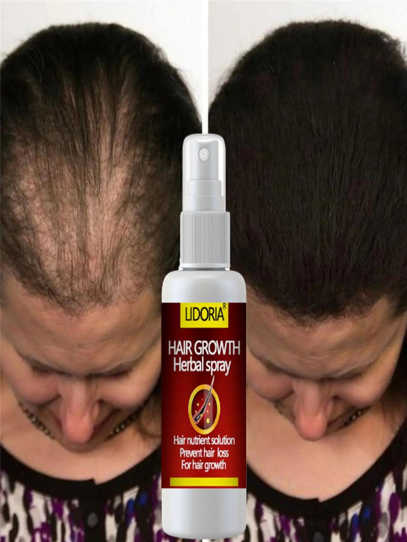 Hair Growth Serum Spray Fast Hair Growth Liquid Treatment Scalp Hair Follicle anti Hair Loss Natural Beauty Health Hair Care