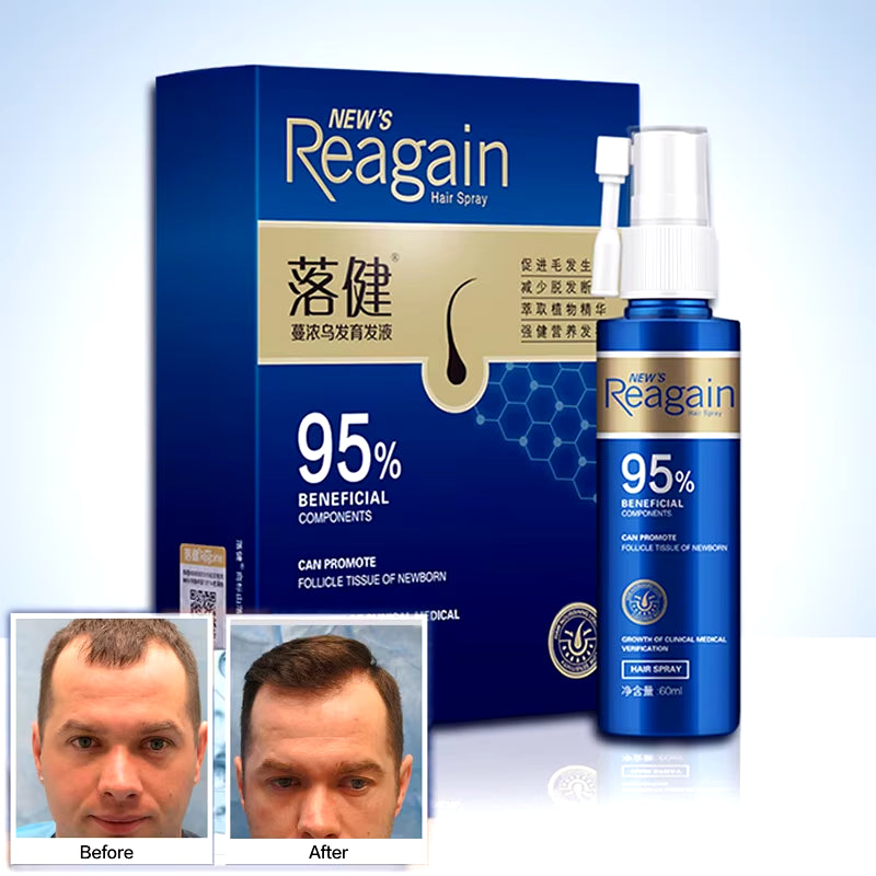 Anti Hair Loss Regrowth Essence Hair Growth Serum Sprayer Hair Regrowth for Men Rapid Growth Essence Prevent Hair from Falling