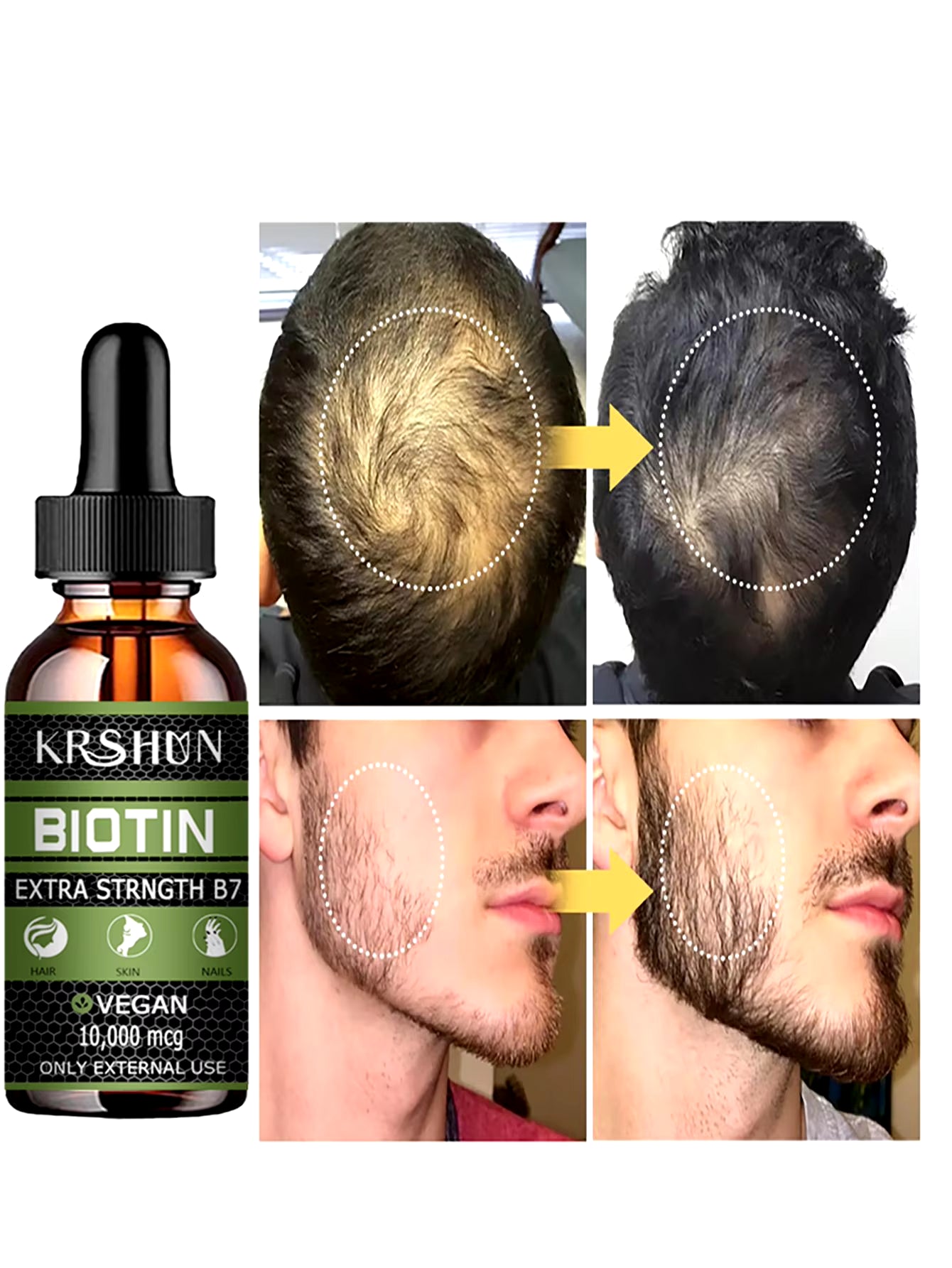 2022 Biotin Fast Hair Growth Oil Hair Regrowth Serum Hair Thinning Treatment Hair Growth Liquid Anti-Hair Loss for Women & Men