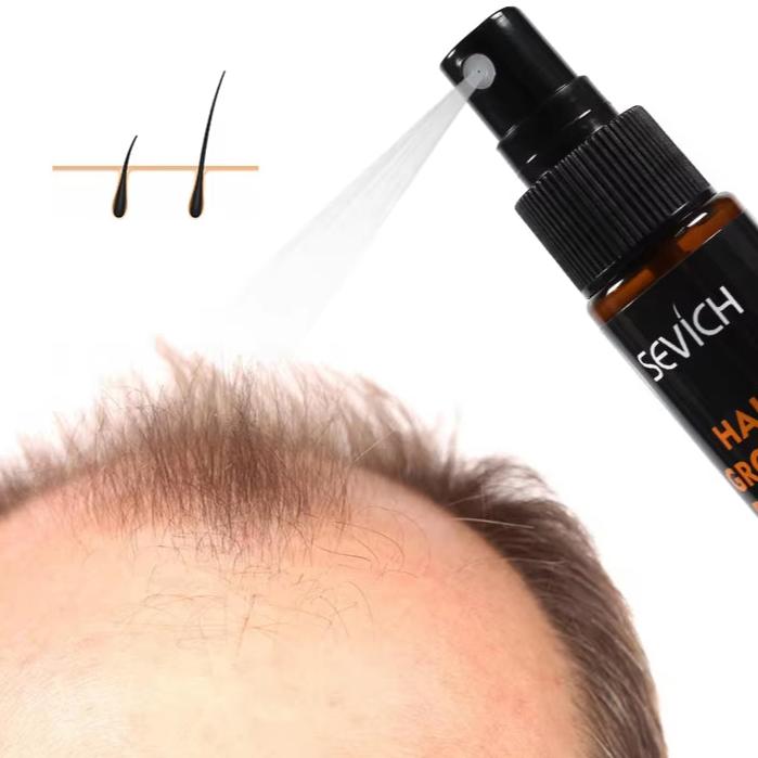 Hair Growth Essence Spray 30Ml Hair Loss Product Hair Regrowth Spray anti Hair Loss Treatment Thicken Thin Hair